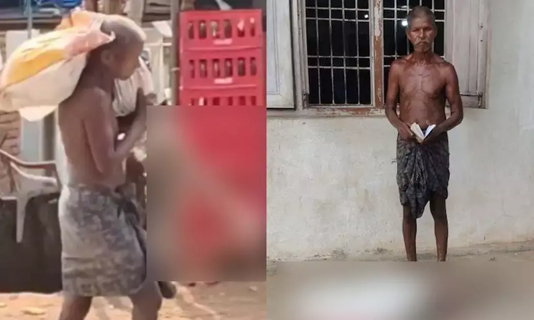 19,300 ರೂ. ಹಣಕ್ಕಾಗಿ ಮೃತ ತಂಗಿಯ ಅಸ್ಥಿಪಂಜರ ಹೊತ್ತು ಬ್ಯಾಂಕ್‌ಗೆ ಬಂದ ಸಹೋದರ!