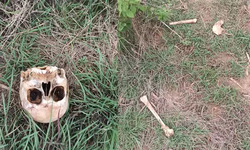 ಆನೇಕಲ್ | ಕೆರೆಯಂಗಳದಲ್ಲಿ ಮಾನವ ಕಳೇಬರ ಪತ್ತೆ