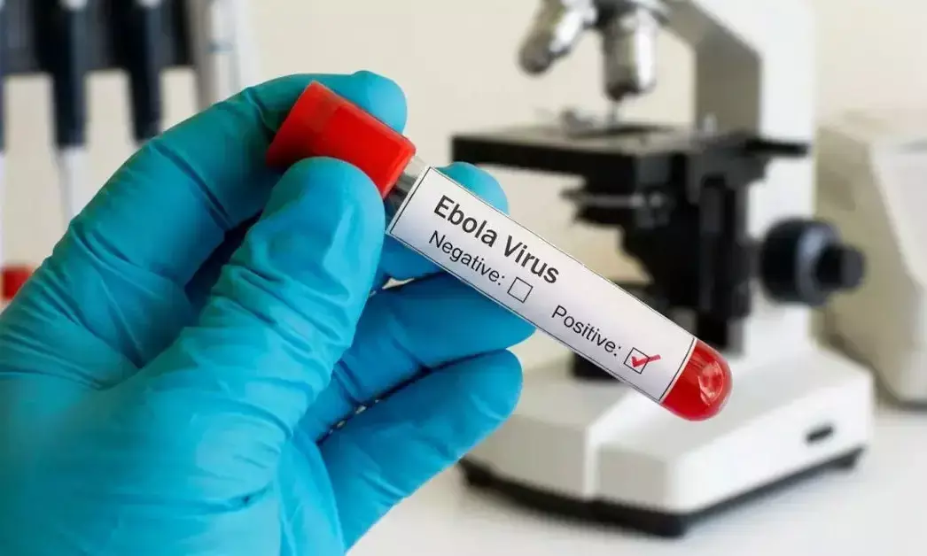 Ebola ಸಾಂಕ್ರಾಮಿಕ ರೋಗದ ಭೀತಿ : ಮೂರು ದೇಶಗಳಿಗೆ ಪ್ರಯಾಣಿಸದಂತೆ ಭಾರತ ಸಲಹೆ