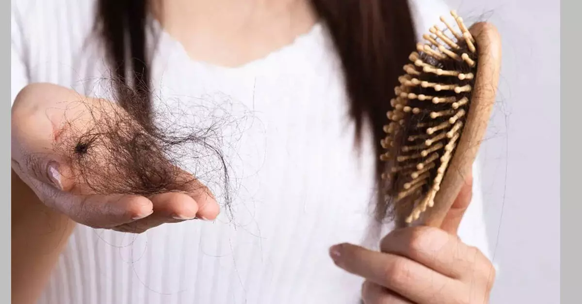 ದಿಂಬಿನ ಮೇಲೆ ಕೂದಲು; ಋತುಮಾನದ ಕೂದಲುದುರುವಿಕೆ ಅಥವಾ ರೋಗವೆಂದು ಗುರುತಿಸುವುದು ಹೇಗೆ? ದಿಂಬಿನ ಮೇಲೆ ಕೂದಲು; ಋತುಮಾನದ ಕೂದಲುದುರುವಿಕೆ ಅಥವಾ ರೋಗವೆಂದು ಗುರುತಿಸುವುದು ಹೇಗೆ?