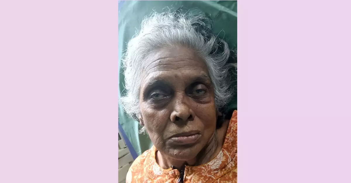 Udupi | ತಾಯಿಯನ್ನೇ ರಸ್ತೆಬದಿಯಲ್ಲಿ ಬಿಟ್ಟು ತೆರಳಿದ ಮಗ: ಬ್ರಹ್ಮಾವರದಲ್ಲೊಂದು ಅಮಾನವೀಯ ಘಟನೆ Udupi | ತಾಯಿಯನ್ನೇ ರಸ್ತೆಬದಿಯಲ್ಲಿ ಬಿಟ್ಟು ತೆರಳಿದ ಮಗ: ಬ್ರಹ್ಮಾವರದಲ್ಲೊಂದು ಅಮಾನವೀಯ ಘಟನೆ