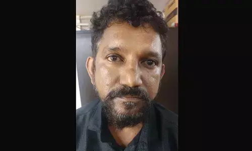 ಉಡುಪಿ | ಮುಂಗಡ ಹಣದ ವಿಚಾರದಲ್ಲಿ ಗಲಾಟೆ: ಮನೆ ಮಾಲಕನ ಮೇಲೆ ಆ್ಯಸಿಡ್ ದಾಳಿ; ಆರೋಪಿ ಬಂಧನ