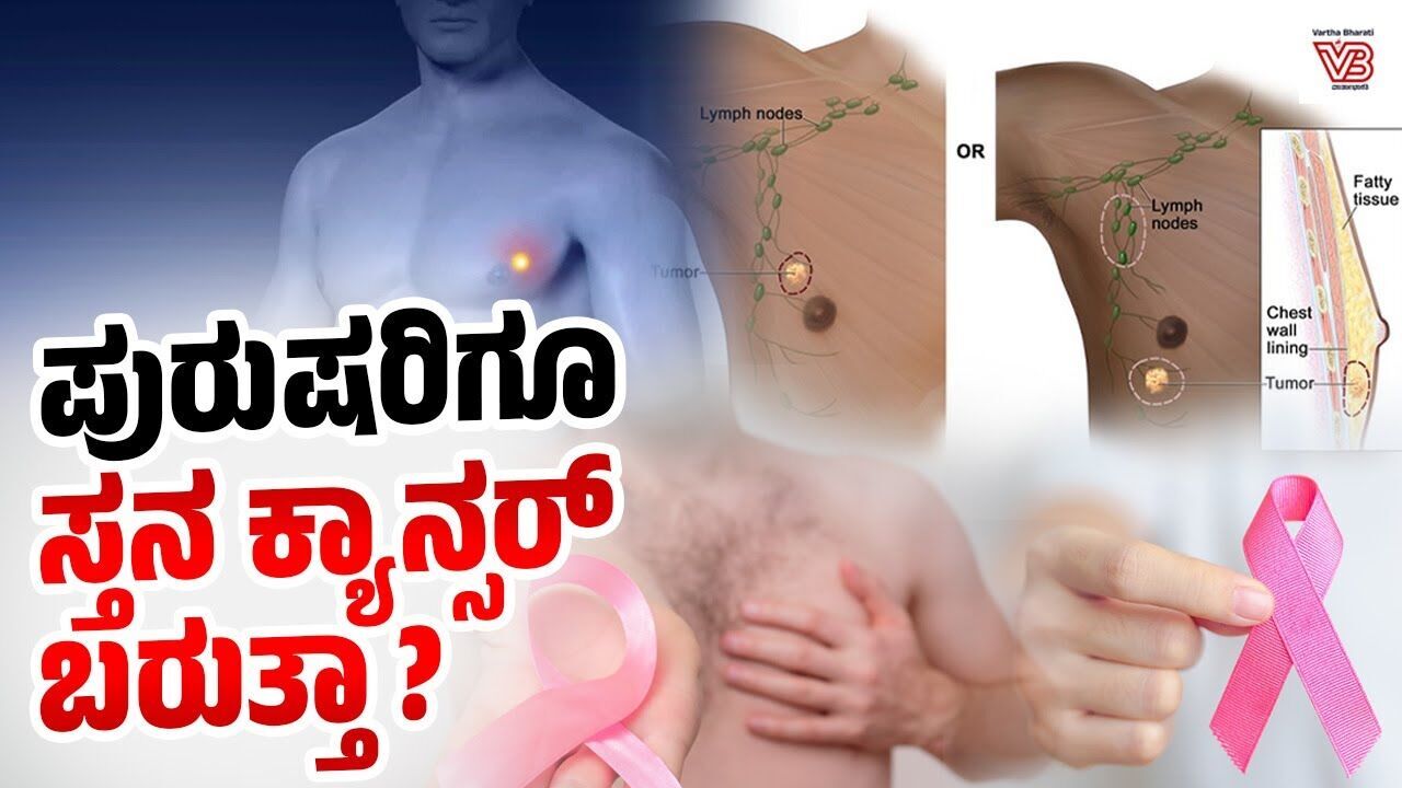 ಪುರುಷರಿಗೆ ಸ್ತನ ಕ್ಯಾನ್ಸರ್ ಏಕೆ ಬರುತ್ತದೆ? ಅದಕ್ಕೆ ಚಿಕಿತ್ಸೆ ಏನು? | Male breast cancer