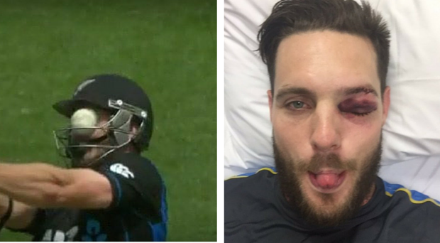 ಪಾಕಿಸ್ತಾನ-ನ್ಯೂಝಿಲೆಂಡ್‌ ಸರಣಿ: ಅನ್ವರ್ ಅಲಿ ಬೌಲಿಂಗ್‌ನಲ್ಲಿ ಮೆಕ್ಲೆನಘನ್ ಕಣ್ಣಿಗೆ ಗಾಯ