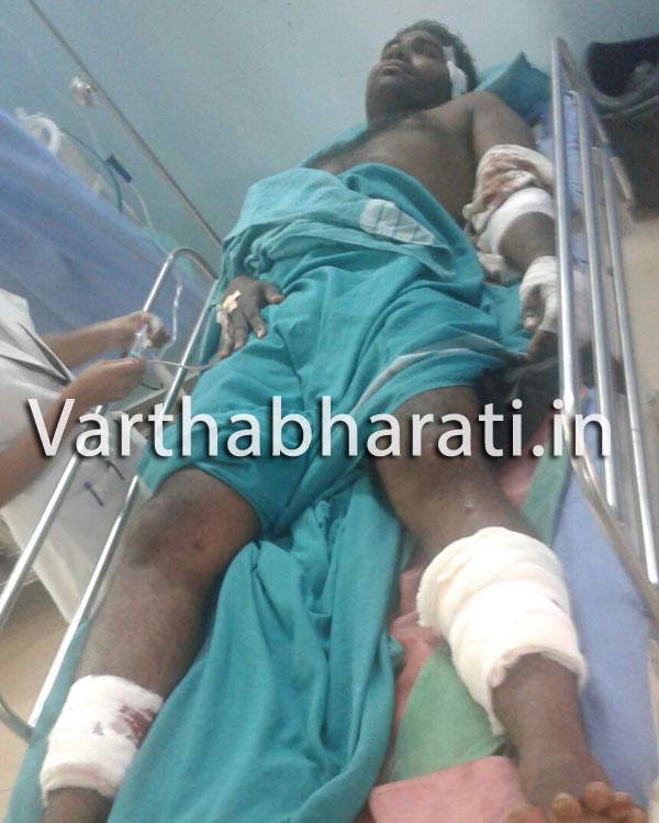 ಮುಲ್ಕಿ,: ಅಪರಿಚಿತರಿಂದ ಗಂಭೀರ ಹಲ್ಲೆ ಗಾಯಾಲು ಆಸ್ಪತ್ರೆಗೆ