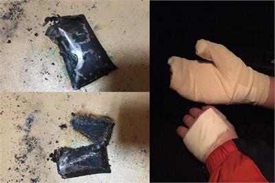 ಚಾರ್ಜಿಗಿಟ್ಟ ಮೋಬೈಲ್ ಸ್ಪೋಟ: ಆಪತ್ತು ಕಾದಿದೆ !