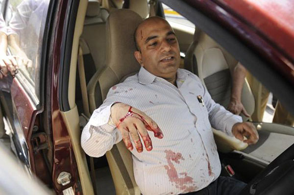 ಸಮಯಪ್ರಜ್ಞೆಯಿಂದ ಬದುಕಿ, ಹಂತಕನನ್ನೂ ಜೈಲಿಗೆ ಕಳಿಸಿದ ಆರ್ಕಿಟೆಕ್ಟ್