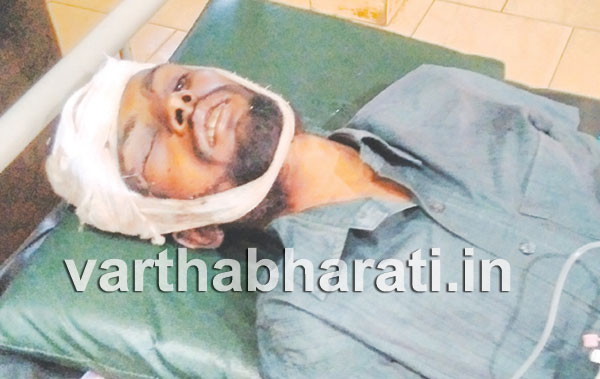 ಕಾಸರಗೋಡು : ರೈಲು ಬಡಿದು  ಬಂಗಾಳ ನಿವಾಸಿಯೋರ್ವ ಗಂಭೀರ ಗಾಯ