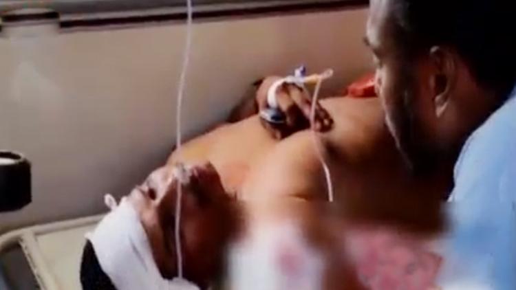 ತಲಶ್ಶೇರಿಯಲ್ಲಿ ಬಿಜೆಪಿ ಕಾರ್ಯಕರ್ತನಿಗೆ ಹಲ್ಲೆ: ಆಸ್ಪತ್ರೆಗೆ ದಾಖಲು