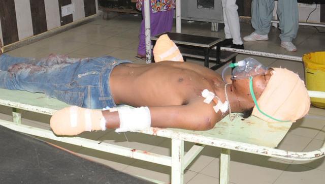 ತನ್ನ 7 ತಿಂಗಳ ಮಗುವಿನ ಮೇಲೆ ಅತ್ಯಾಚಾರ ಮಾಡಿದವನ ಕೈಗಳನ್ನೇ ಕಡಿದು ಹಾಕಿದ ಅಪ್ಪ