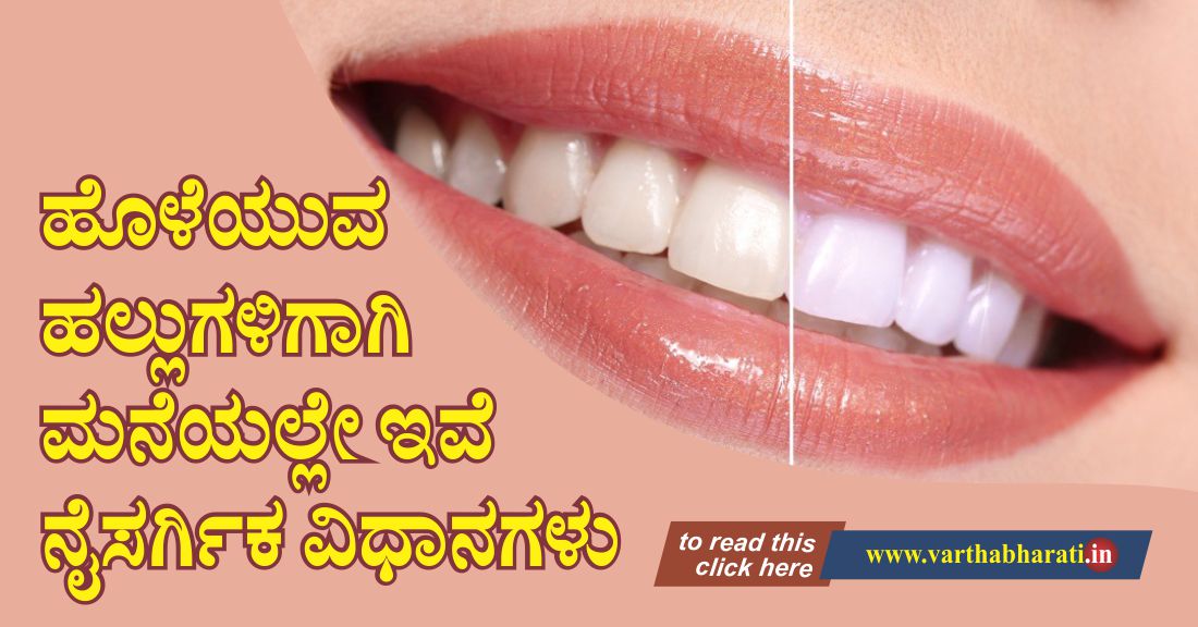 ಹೊಳೆಯುವ ಹಲ್ಲುಗಳಿಗಾಗಿ ಮನೆಯಲ್ಲೇ ಇವೆ ನೈಸರ್ಗಿಕ ವಿಧಾನಗಳು
