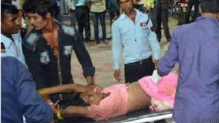 ಭೀಕರ ರಸ್ತೆ ಅಪಘಾತ: ಕಾಲು ಕಳೆದುಕೊಂಡ ಏಳು ಮಹಿಳೆಯರು!