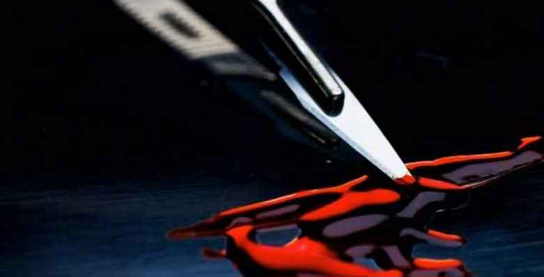 ವಲಸಿಗರ ವೃಷಣಕ್ಕೇ ಕುತ್ತು ತಂದ ವೈದ್ಯ!