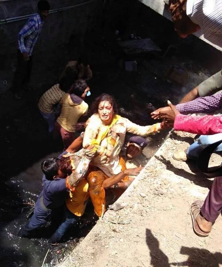 ಚರಂಡಿಗೆ ಬಿದ್ದ ಗುಜರಾತ್ ಸಂಸದೆ; ಮೂಳೆ ಮುರಿತ, ತಲೆಗೆ ಗಾಯ