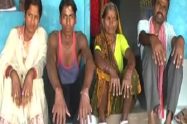 ಈ ಕುಟುಂಬದ ಎಲ್ಲ ಸದಸ್ಯರಲ್ಲಿ 22,24,25,27ರವರೆಗೂ ಬೆರಳುಗಳು!