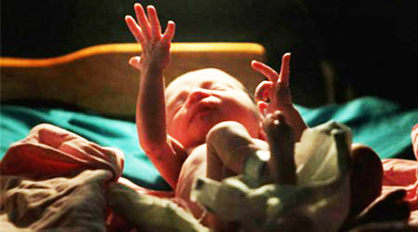 ಚೀನಾದಲ್ಲಿ ಭ್ರೂಣದೊಂದಿಗೇ ಹುಟ್ಟಿದ ಮಗು