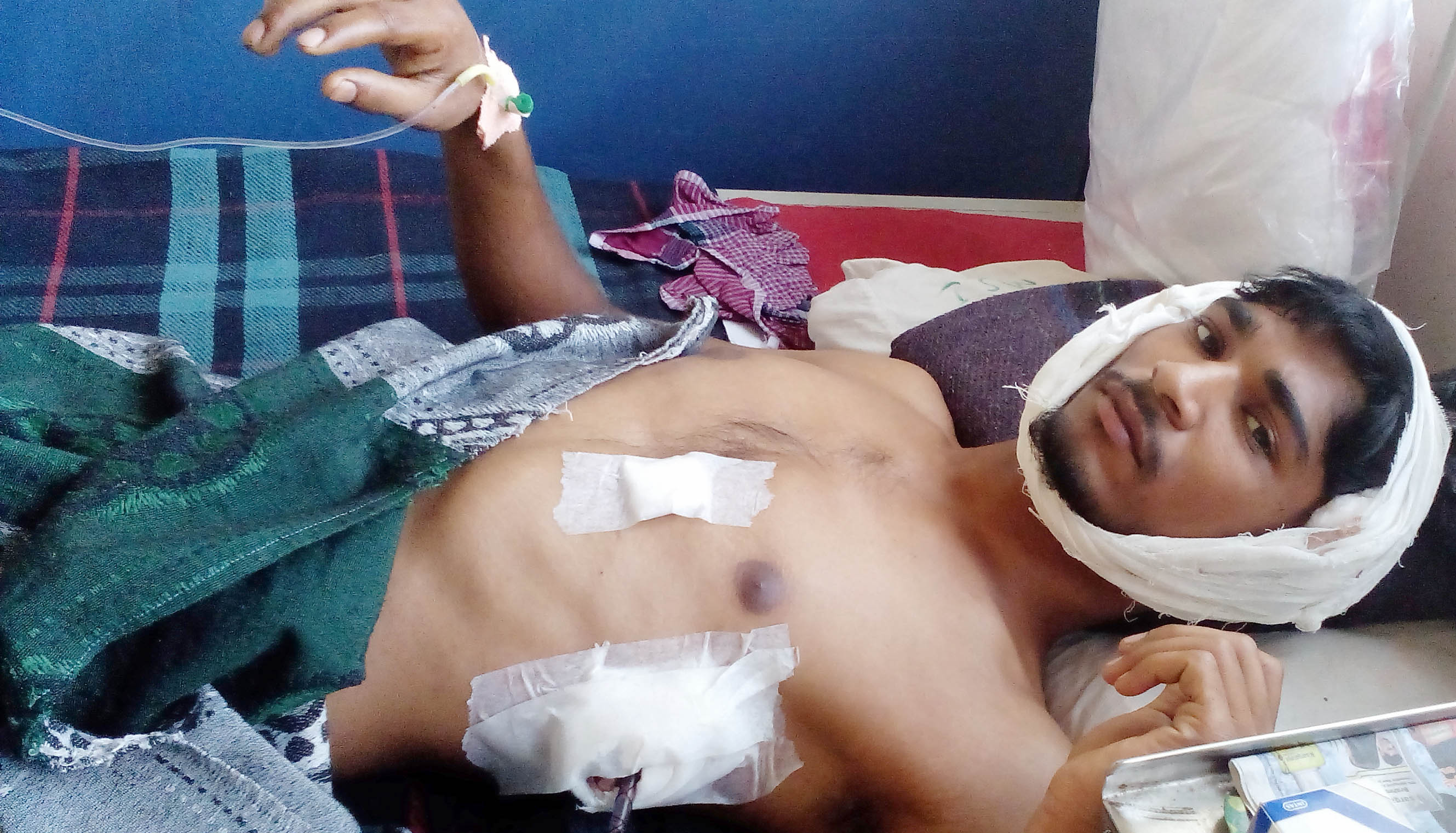 ದಲಿತ ವಿದ್ಯಾರ್ಥಿಯ ಮೇಲೆ ಮಾರಣಾಂತಿಕ ಹಲ್ಲೆ