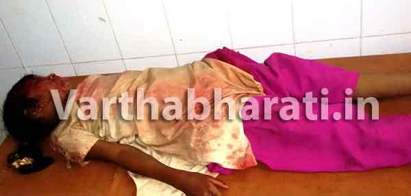 ಮುಂಡಗೋಡ: ಕಾರು ಢಿಕ್ಕಿಯಾಗಿ ಬಾಲಕಿಗೆ ಗಂಭೀರ ಗಾಯ