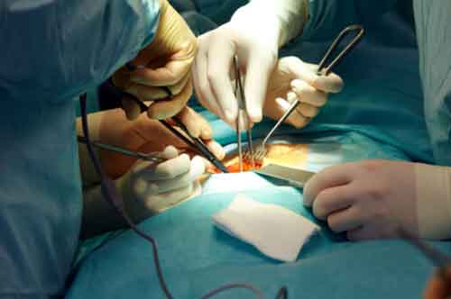 ಗಾಯಗೊಂಡ ಬಲಗಾಲನ್ನು ಬಿಟ್ಟು ಎಡಗಾಲಿಗೆ ಶಸ್ತ್ರಚಿಕಿತ್ಸೆ ಮಾಡಿದ ಫೋರ್ಟಿಸ್ ಆಸ್ಪತ್ರೆಯ ವೈದ್ಯರು