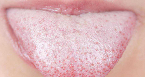 ಬಾಯಿಯ ಗಾಯಕ್ಕೆ ಪರಿಣಾಮಕಾರಿ ಮನೆ ಮದ್ದುಗಳು