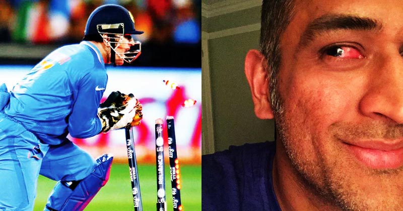 ಮಂಜಾದ ದೃಷ್ಟಿ, ವಿಪರೀತ ನೋವಿನೊಂದಿಗೆ ವಿಕೆಟ್‌ಕೀಪಿಂಗ್ ನಡೆಸಿದ ಧೋನಿ!