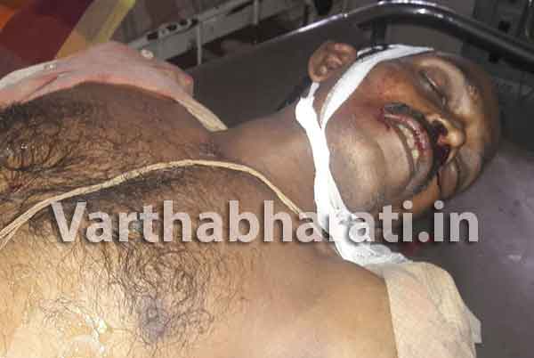 ಕಾರ್ಕಳ: ವಿದ್ಯುತ್ ಕಂಬದಿಂದ ಬಿದ್ದು ಕಾರ್ಮಿಕ ಮೃತ್ಯು