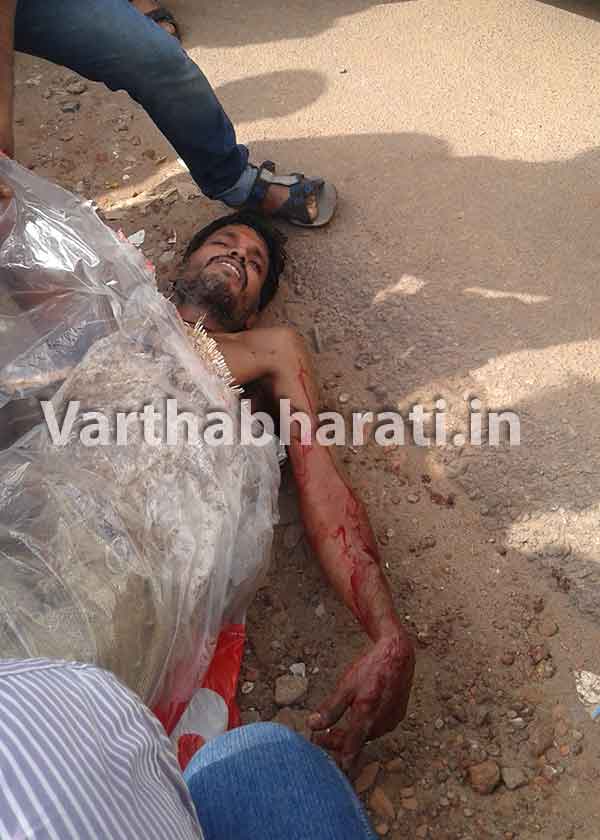 ಕುಳಾಯಿ: ಚೂರಿಯಿಂದ ಇರಿದುಕೊಂಡು ವ್ಯಕ್ತಿಯಿಂದ ಆತ್ಮಹತ್ಯೆಗೆ ಯತ್ನ