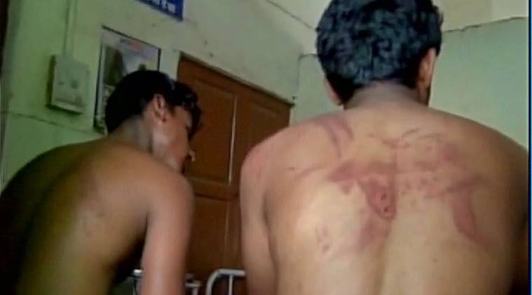 ಇಬ್ಬರು ದಲಿತರ ಮೇಲೆ  25 ಮಂದಿಯ ತಂಡದಿಂದ ಬರ್ಬರ ಥಳಿತ