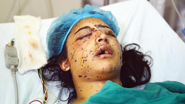 ಕಾಶ್ಮೀರದಲ್ಲಿ 17 ಲಕ್ಷ ಪೆಲೆಟ್ ಗನ್ ಬಳಕೆ! - ಸಿಆರ್‌ಪಿಎಫ್ ಬಹಿರಂಗ