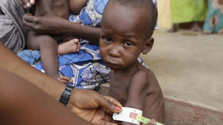 ನೈಜೀರಿಯದಲ್ಲಿ ಈ ವರ್ಷ49,000 ಮಕ್ಕಳು ಸಾಯುವ ಭೀತಿ: ಯುನಿಸೆಫ್