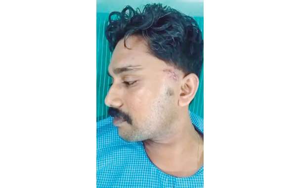 ಹೆಲ್ಮೆಟ್ ಧರಿಸದ್ದಕ್ಕೆ ವಯರ್‌ಲೆಸ್ ಸೆಟ್‌ನಿಂದ ಕಪಾಳಮೋಕ್ಷ : ಬೈಕ್ ಸವಾರ ಗಂಭೀರ