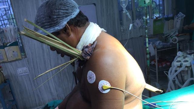 ವ್ಯಕ್ತಿಯ ಕುತ್ತಿಗೆಯಿಂದ ಹೋಗಿ ಬೆನ್ನಲ್ಲಿ ಹೊರಬಂದ 3 ಅಡಿ ಉದ್ದದ ಬಿದಿರು ! ಬಳಿಕ ಏನಾಯಿತು ನೋಡಿ