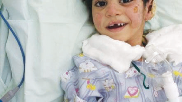 ಪೆಟ್ರೋಲ್ ಬಂಕ್‌ನಲ್ಲಿ ವಾಹನಕ್ಕೆ ಬೆಂಕಿ: ಗಾಯಾಳು ಮಗುವಿಗೆ ಮರಳಿದ ಪ್ರಜ್ಞೆ