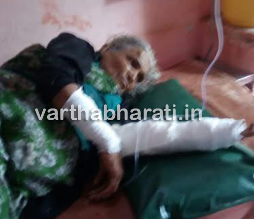 ಪುತ್ತೂರು: ಬಸ್ಸಿನಡಿಗೆ ಬಿದ್ದು ಮಹಿಳೆ ಗಂಭೀರ ಗಾಯ