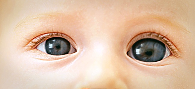 ಮಕ್ಕಳಲ್ಲಿ ಕಣ್ಣಿನ ರೋಗಗಳು