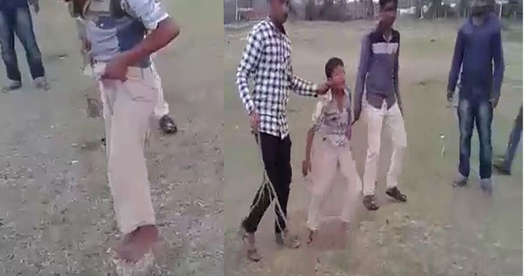 ತೆಂಗಿನ ಮರ ಏರಿದ ಬಾಲಕನಿಗೆ ವಿಚಿತ್ರ ಚಿತ್ರಹಿಂಸೆ !