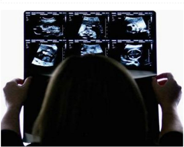 ಲಿಂಗ ಪತ್ತೆ ಪ್ರಕರಣ ನಿಗಾಗೆ ಸಮಿತಿ ರಚಿಸಿ: ಹೈಕೋರ್ಟ್‌ಗಳಿಗೆ ಸುಪ್ರೀಂ ಸೂಚನೆ