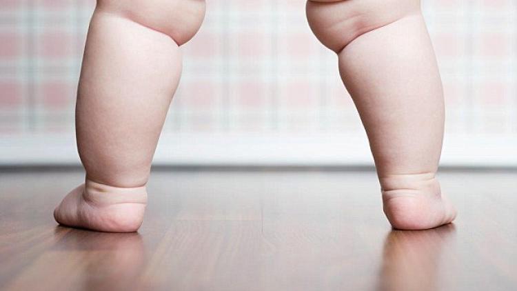 ಸಿಸೇರಿಯನ್‌ನಲ್ಲಿ ಜನಿಸಿದ ಶಿಶುಗಳಿಗೆ ಬೊಜ್ಜುದೇಹ ಸಾಧ್ಯತೆ