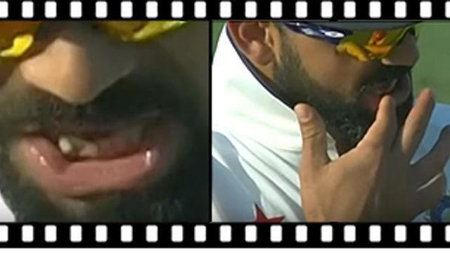 ವಿರಾಟ್ ಕೊಹ್ಲಿ ವಿರುದ್ಧ ಚೆಂಡು ವಿರೂಪ ಆರೋಪ!