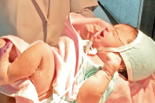 ಆಸ್ಪತ್ರೆಯ ಶೌಚಾಲಯದಲ್ಲಿ ಮಗುವಿಗೆ ಜನ್ಮವಿತ್ತು ಗೆಳೆಯನ ಬೈಕನ್ನೇರಿ ಪರಾರಿಯಾದ ಯುವತಿ !