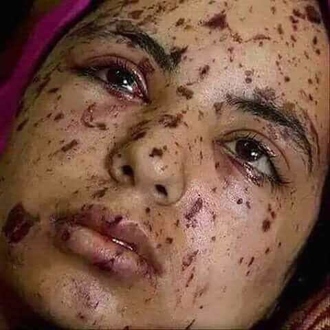 ಕಾಶ್ಮೀರ ಪ್ರತಿಭಟನಕಾರರ ವಿರುದ್ಧ ವಿವೇಚನಾರಹಿತ ಬಲ ಪ್ರಯೋಗ : ಅಮೆರಿಕದ ಮಾನವಹಕ್ಕು ಗುಂಪು ಆರೋಪ