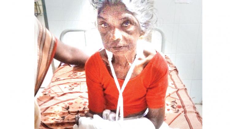 ಪೆಟ್ಟು ತಿಂದ ವೃದ್ಧೆ ಆಸ್ಪತ್ರೆಯಲ್ಲಿ: ಸೊಸೆ ವಿರುದ್ಧ ಪ್ರಕರಣ ದಾಖಲು !