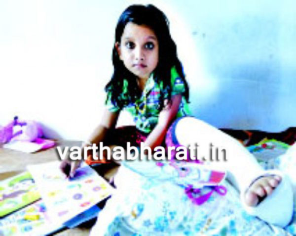 ಈ ಬಾಲಕಿಗೆ ಅಲ್ಪ ದೇಹ ಅಲುಗಾಡಿದರೂ ಎಲುಬು ಮುರಿಯುವ ಭಯ !