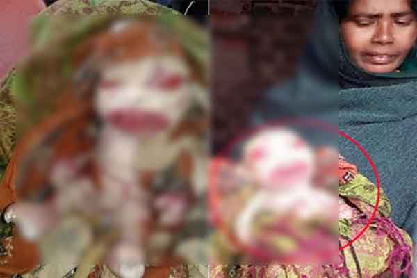 ವಿಚಿತ್ರ ರೂಪದ ಶಿಶು ಜನನ