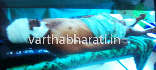 ಕರಡಿ ದಾಳಿ: ರೈತನಿಗೆ ಗಂಭೀರ ಗಾಯ