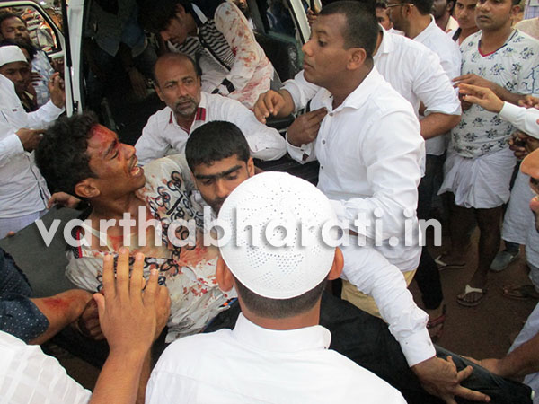 ಭಟ್ಕಳ: ರಸ್ತೆ ಅಪಘಾತ; ಇಬ್ಬರು ಗಂಭೀರ