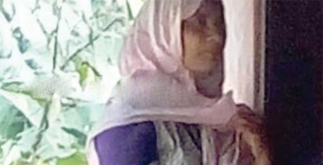 ಜಿನ್ನ್ ಚಿಕಿತ್ಸೆ ಹೆಸರಲ್ಲಿ ಯುವತಿಗೆ ಗಂಭೀರ ಸುಟ್ಟ ಗಾಯ : ಮಹಿಳೆ ಸೆರೆ