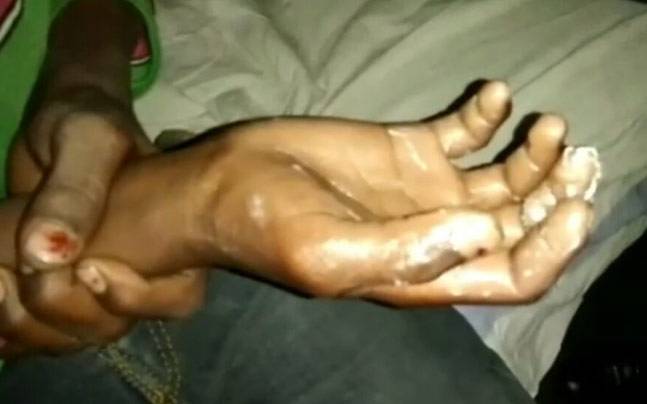 ಮೊಬೈಲ್ ಕದ್ದಿಲ್ಲ ಎಂದು ಸಾಬೀತು ಪಡಿಸಲು ಮಕ್ಕಳಿಗೆ ಕುದಿಯುವ ಎಣ್ಣೆಗೆ ಕೈಮುಳುಗಿಸುವ ಶಿಕ್ಷೆ !