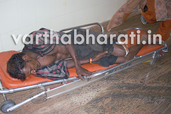 ತೆಂಗಿನಮರದಿಂದ ಬಿದ್ದು ಸೊಂಟ ಮುರಿತ