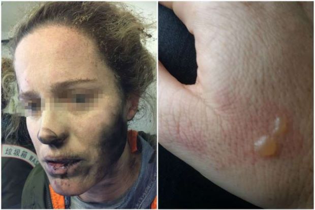 ವಿಮಾನದಲ್ಲಿ ಹೆಡ್‌ಫೋನ್ ಬ್ಯಾಟರಿ ಸ್ಫೋಟ